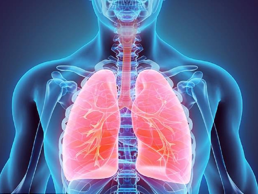 triệu chứng viêm phổi